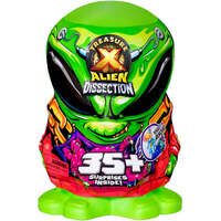 Treasure X - Alien Dissection - Mega Playset
